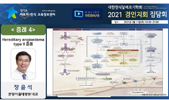 갤러리